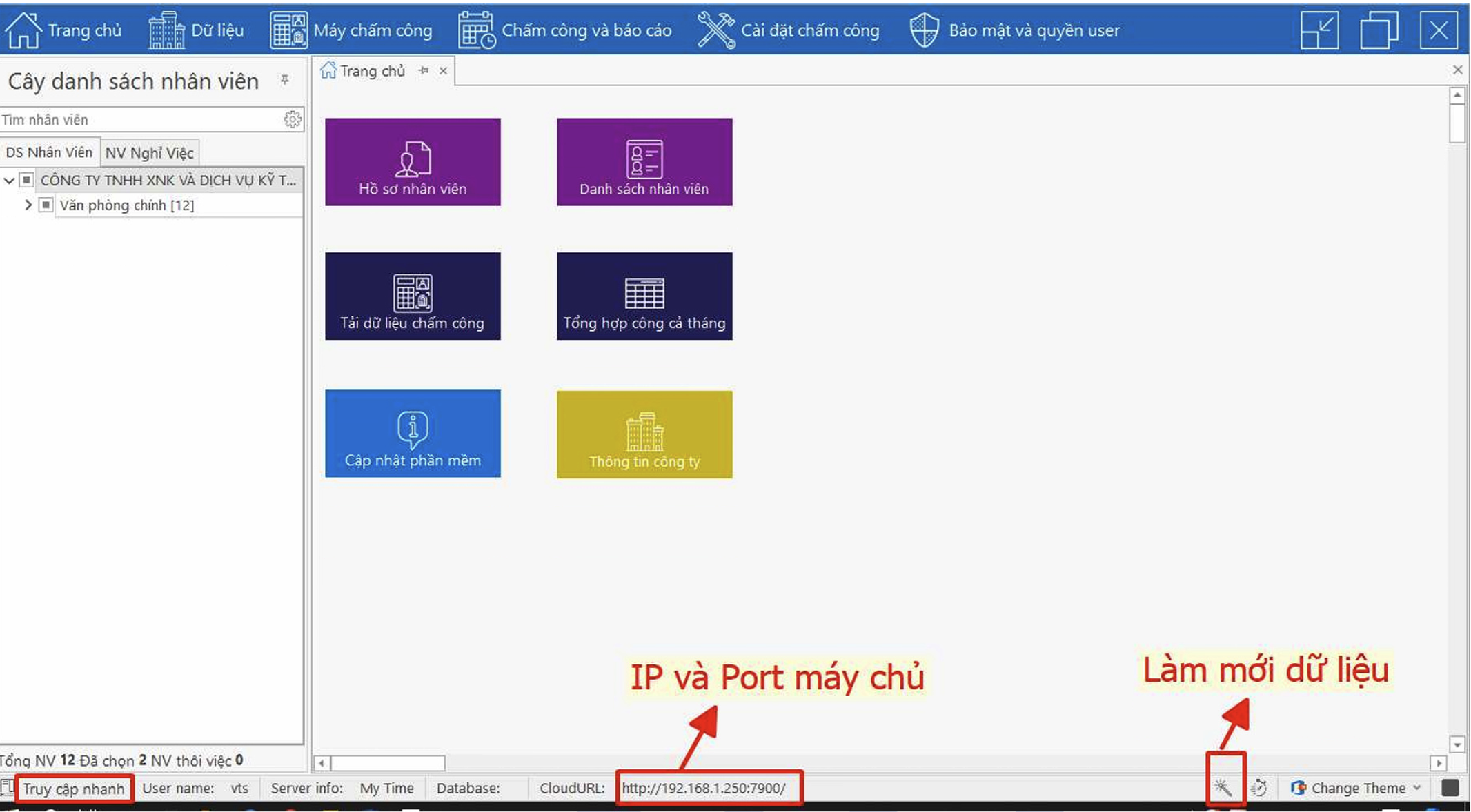 IP và Port Sunbeam/MyTime